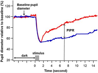 The Post-illumination Pupil Response (PIPR) Is Associated With Cognitive Function in an Epidemiologic Cohort Study